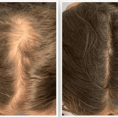 Combo Capilar Nutritivo – Champú de Batana con Romero + Mascarilla con Aceite de Batana