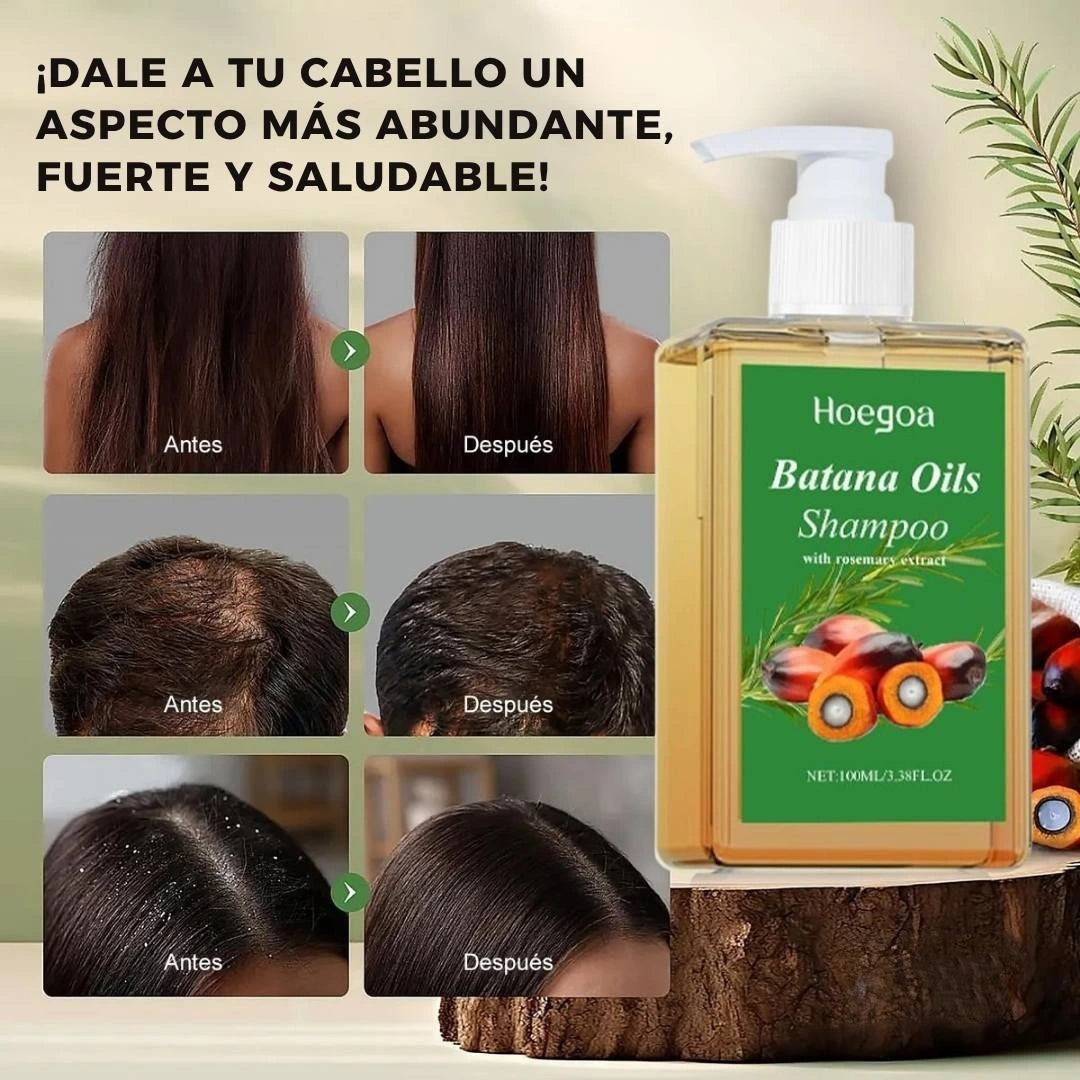 Shampoo BatanaPro™ – Para la caída del cabello y hazlo volver a crecer