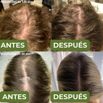 Shampoo BatanaPro™ – Para la caída del cabello y hazlo volver a crecer