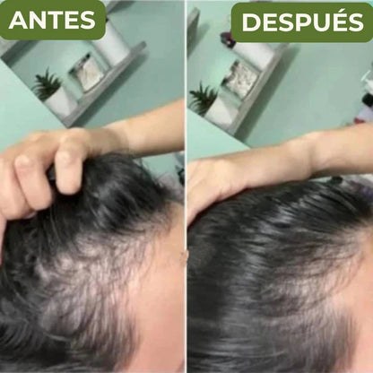 Shampoo BatanaPro™ – Para la caída del cabello y hazlo volver a crecer